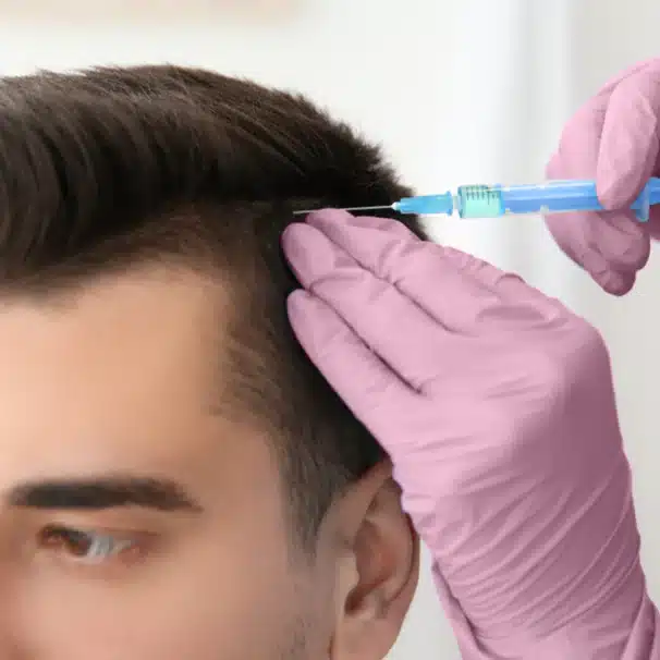 Best Hair Fall Treatment in Hyderabad